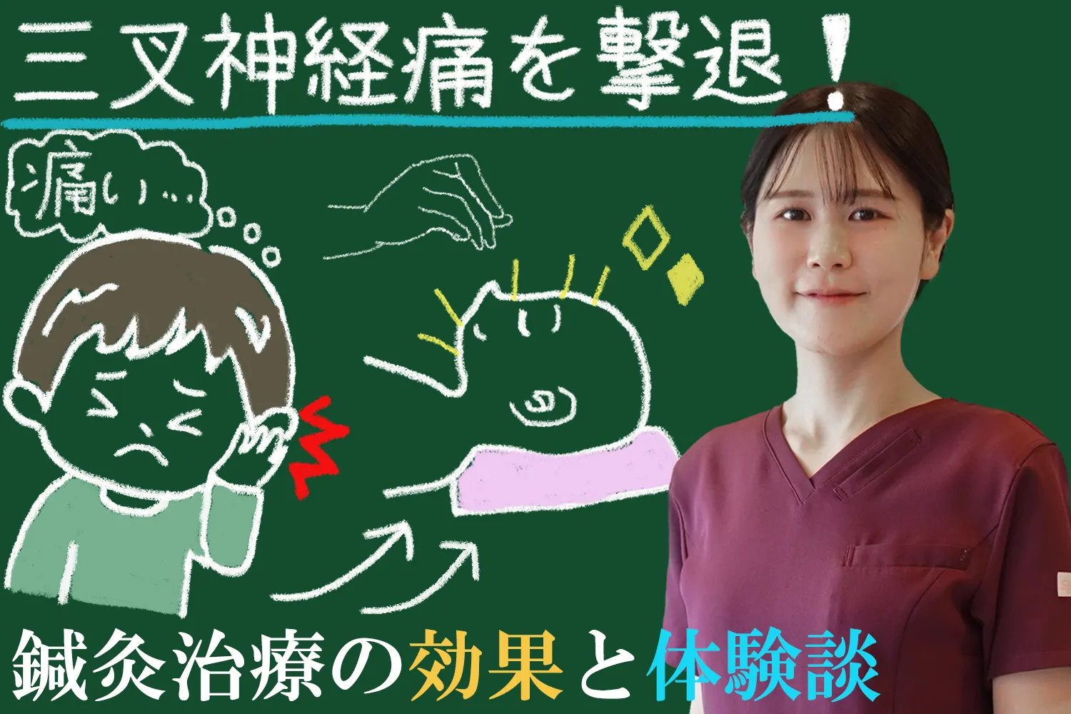 三叉神経痛を撃退！鍼灸治療の効果と体験談をご紹介します