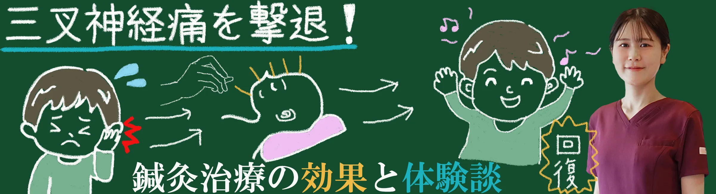 三叉神経痛を撃退できる！？鍼灸治療の効果と体験談をご紹介