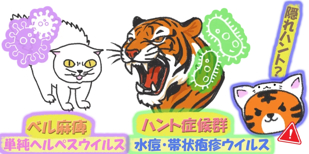 ベル麻痺とハント症候群の違い｜破壊力がネコとトラほどの違い