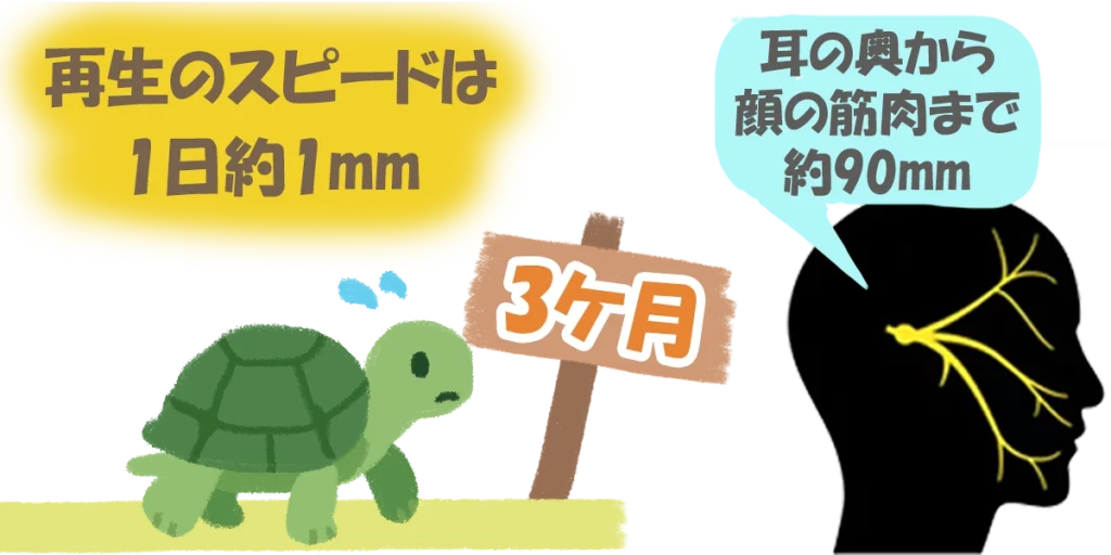 顔面神経麻痺が3ケ月経っても治らない｜「再生スピード」とENoGから見る「重症度」
