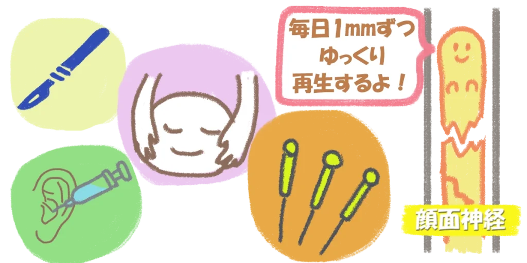 顔面神経麻痺の標準治療｜ステロイドで効果が感じられない場合の選択肢
