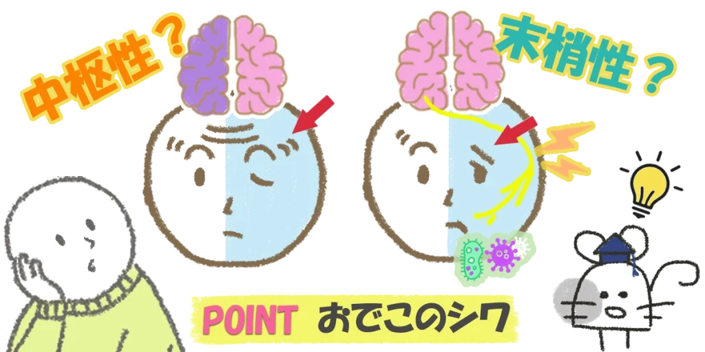顔のゆがみ｜脳の病気かを初期症状で見分けるポイントをご紹介。