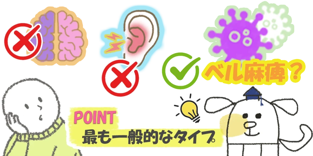 顔面神経麻痺｜除外された症状から最終的な診断がされます。